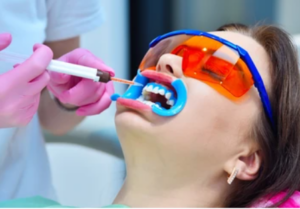 teeth whitening dental health
